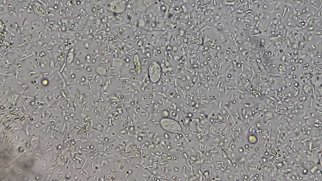 Giardia Lamblia in Drinking Water: Risks and Prevention Methods