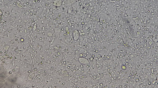 Giardia Lamblia in Drinking Water: Risks and Prevention Methods