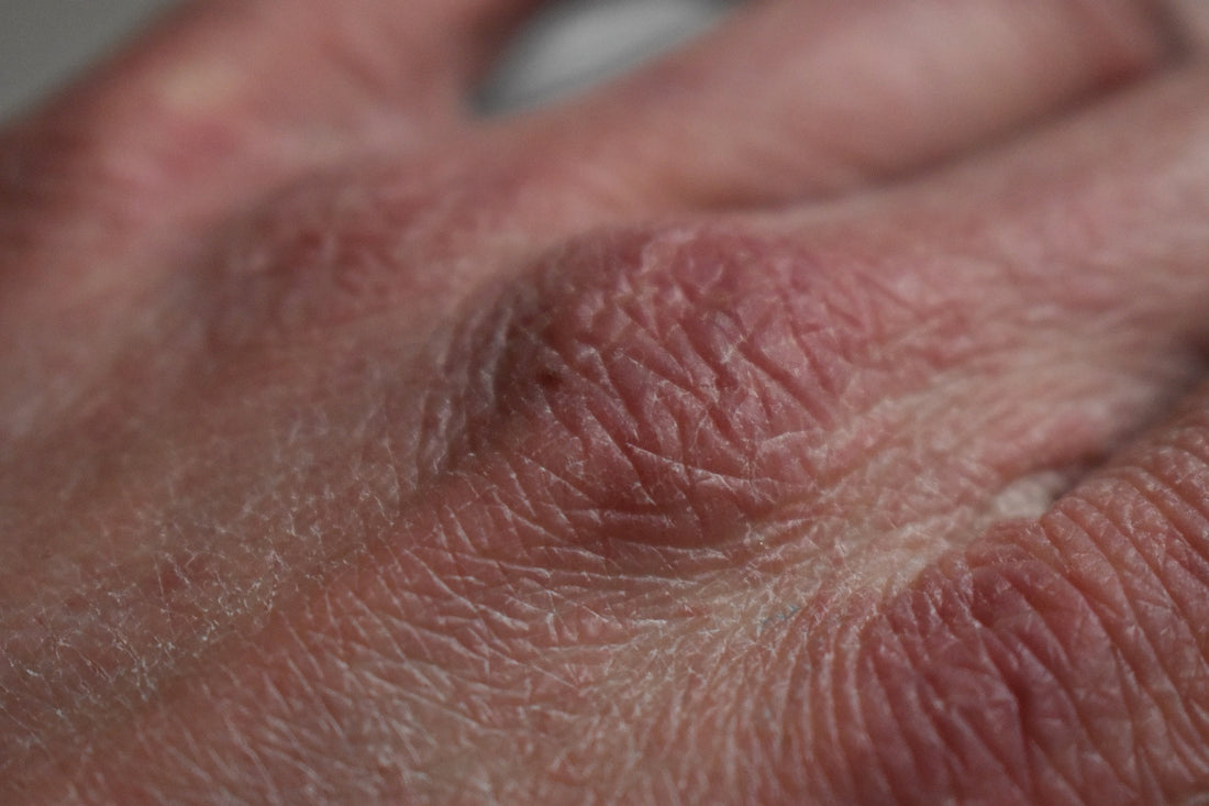 What Are the Top Signs of Hard Water on Hair, Skin, and Nails?