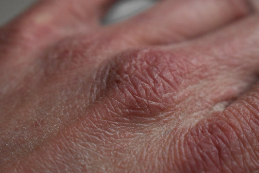 What Are the Top Signs of Hard Water on Hair, Skin, and Nails?