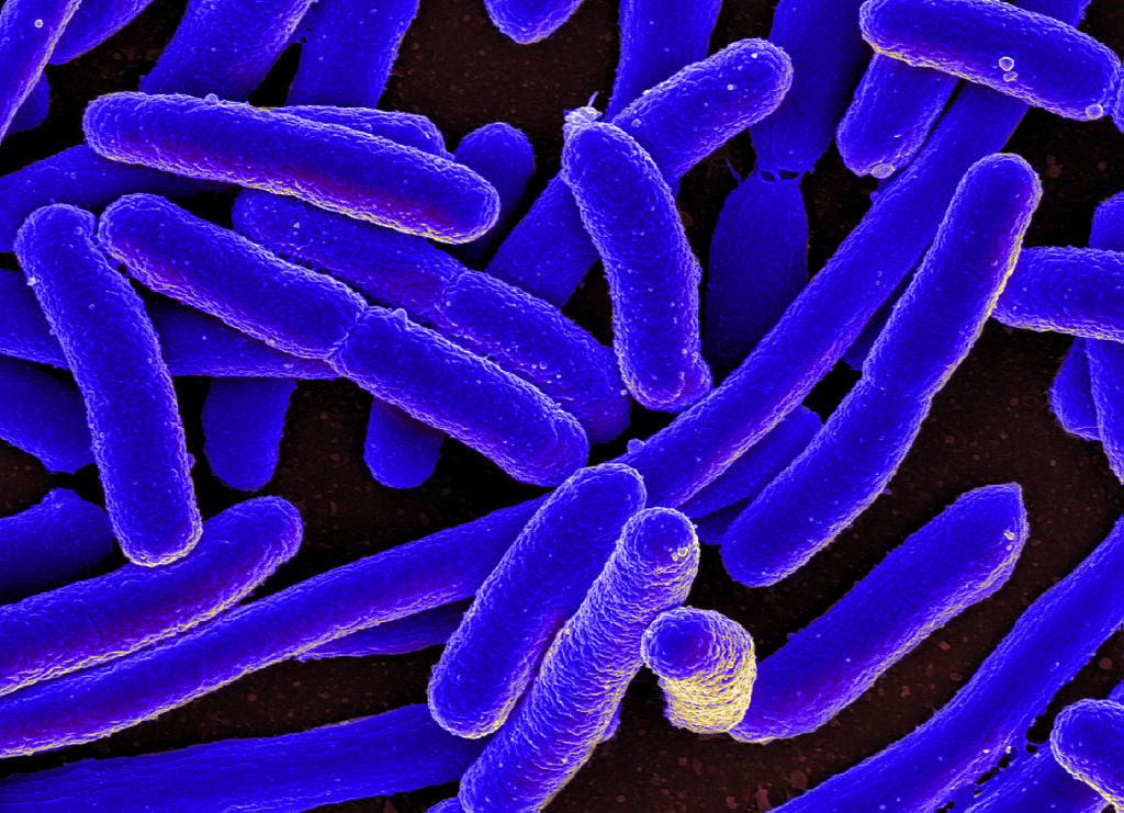 Total Coliforms in Drinking Water: Risks and Solutions