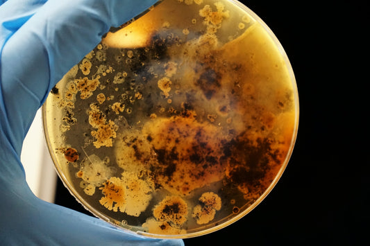 How To Treat Iron Bacteria in Well Water